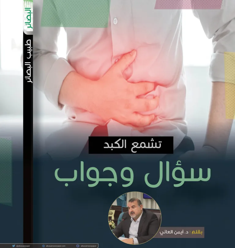 تشمع الكبد؛ سؤال وجواب